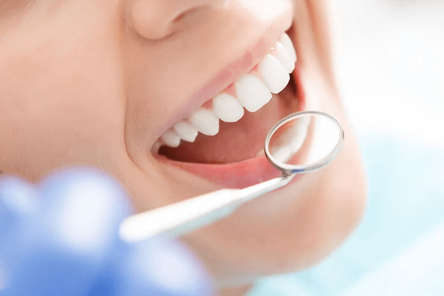 Tẩy trắng răng uy tín nhất TPHCM Nha Khoa Kim